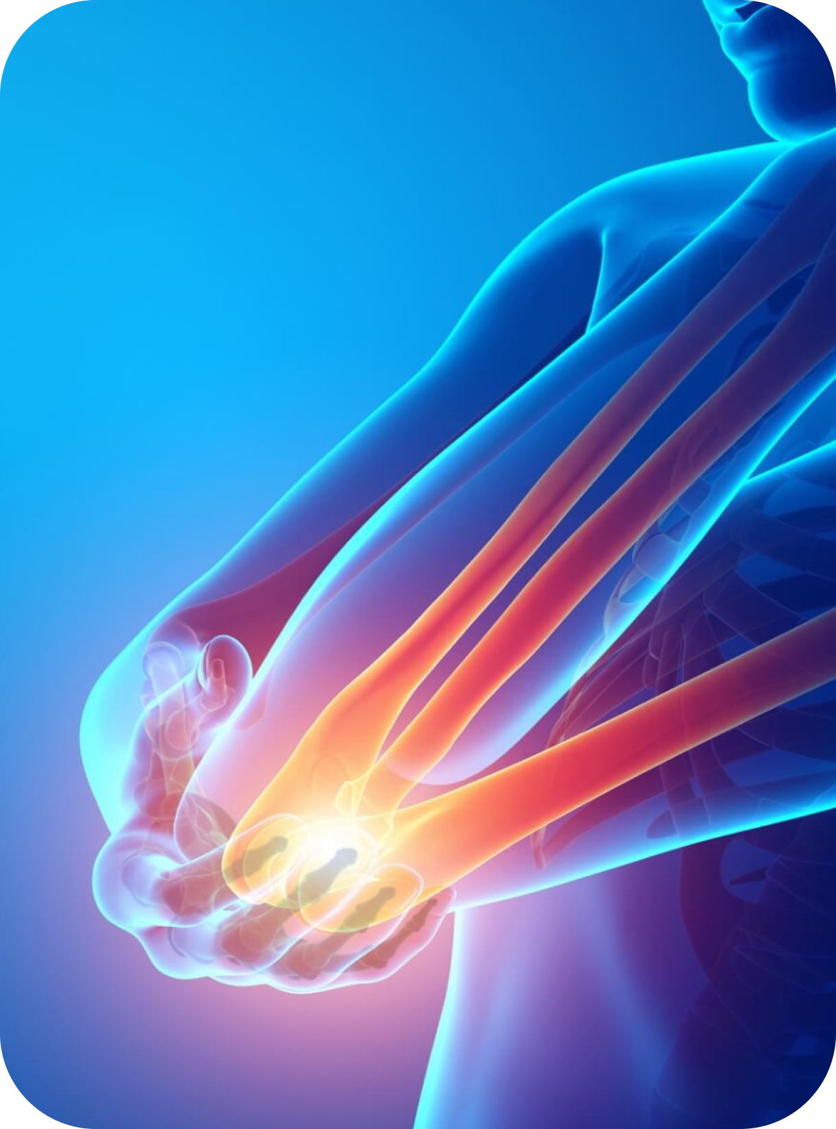 Epicondylalgia
