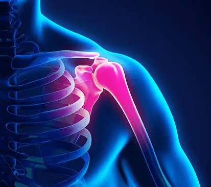 Rotator Cuff Tendinopathy