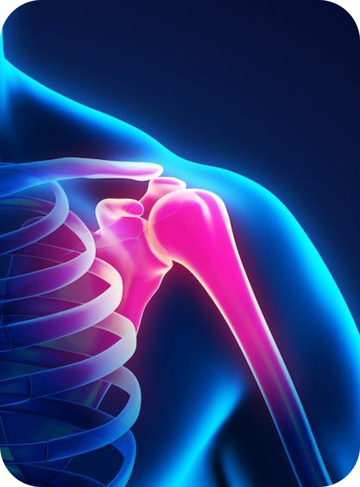 Rotator Cuff Tendinopathy