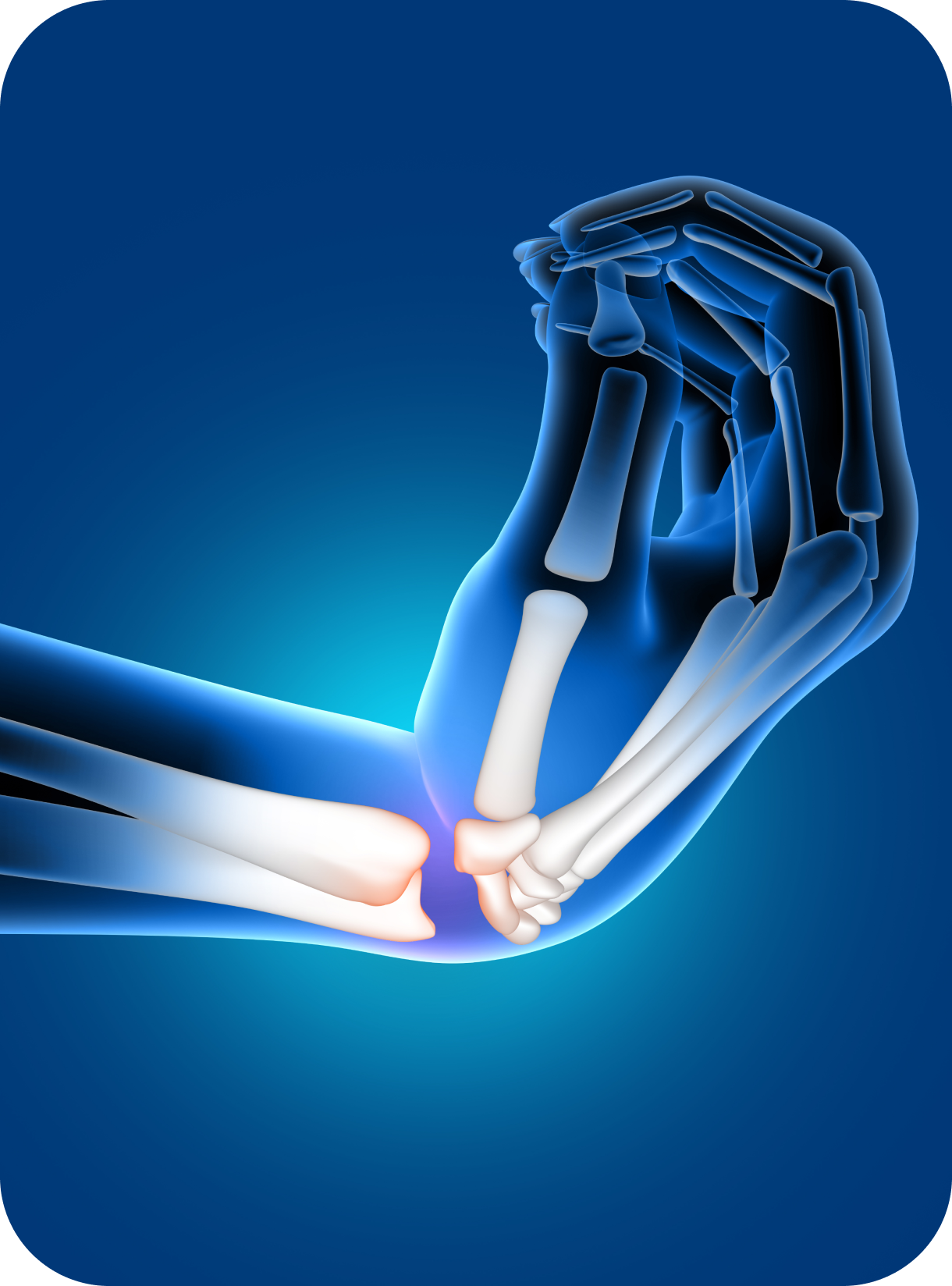 Tenosynovitis